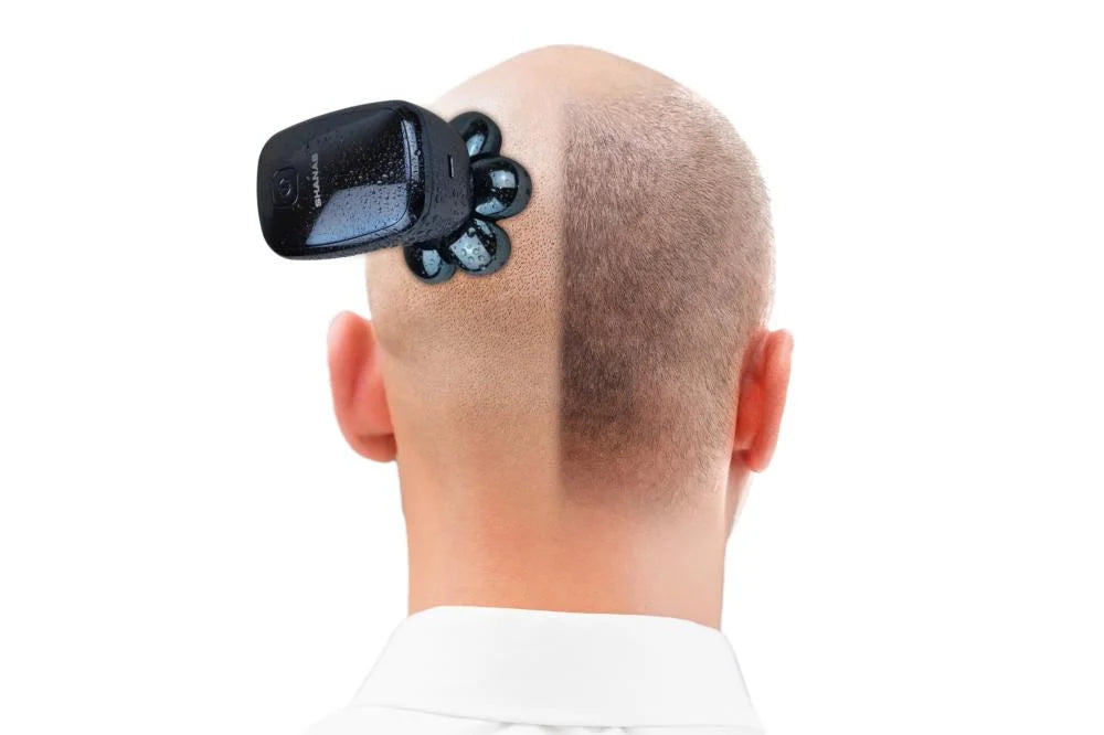 مجموعة مكينة حلاقة شنب للصلع 5 في 1 للرجال الاصدار المطور - SHANAB Electric Head Shavers for Bald Men 5-in-1
